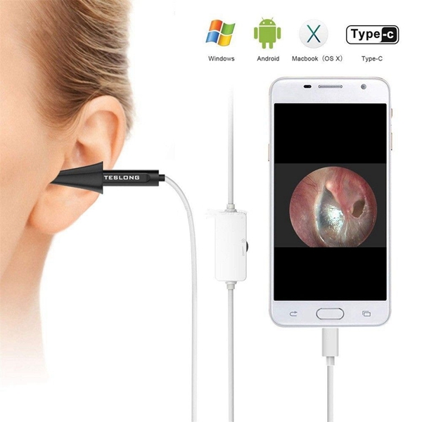 Racdde Digital Otoscope, USB Ear Scope Otology Inspection Camera With 6 LED Lights For Samsung LG Sony Android And PC